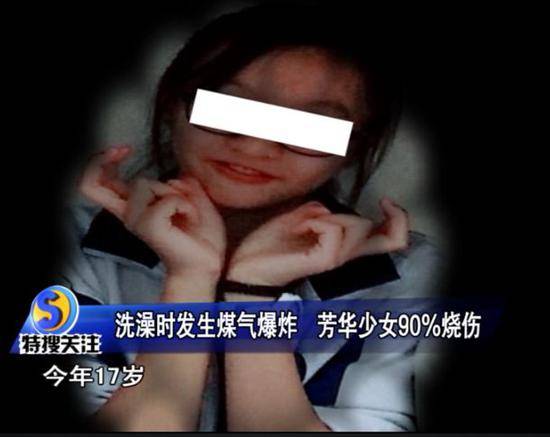 少女洗澡煤气爆炸：像个“火人”一样从洗手间冲出来 手术费上百万
