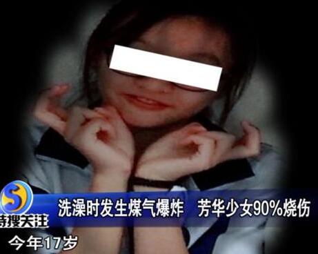 惨不忍睹!少女洗澡煤气爆炸全身90%烧伤  事发前曾闻到煤气味