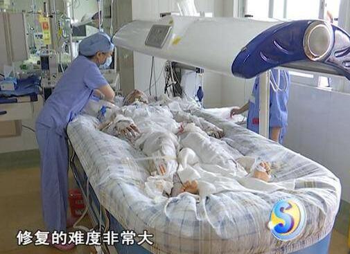 管道爆燃！17岁少女洗澡煤气爆炸 父母手足无措