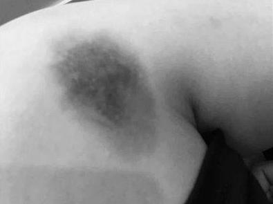 什么仇怨?女生打呼噜遭群殴 8人轮流上演