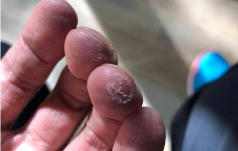 好皮啊！谢霆锋脚纹解锁 背后原因心酸：练吉他手指起茧