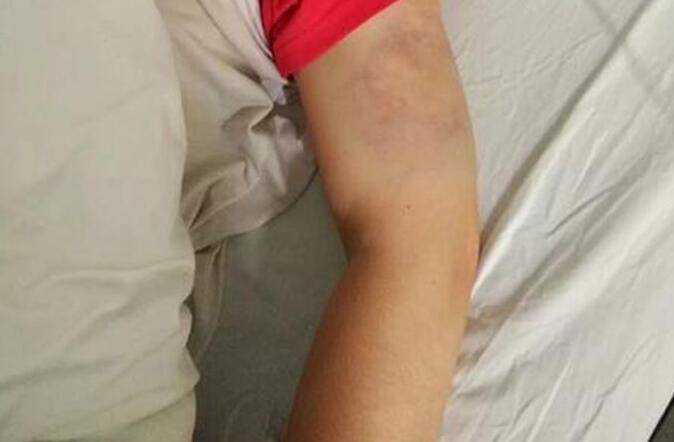 补贴娘家被打 幸福美满的生活却被家暴折磨的千疮百孔