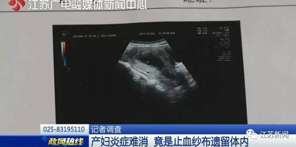 产妇从体内扯出纱布 做手术的大夫这样粗心也没谁了