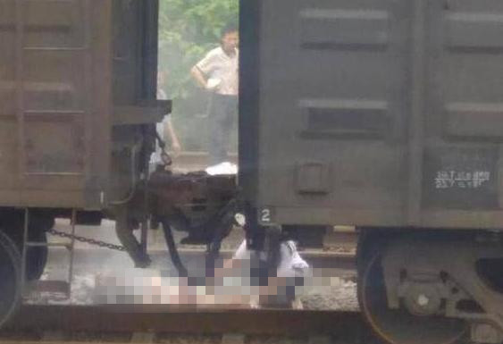 血肉模糊!想当网红惨被烧伤 抖音情侣成反面