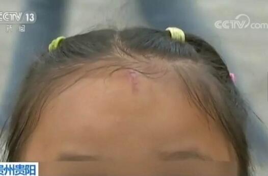 女童被烟盒砸伤 高空坠物五花八门 理赔追责成永恒话题