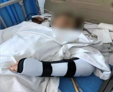 患癌母亲遭陌生男殴打 癌症大妈莫名其妙被一顿拳打脚踢