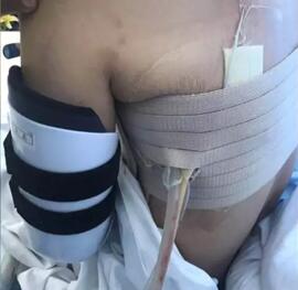 患癌母亲遭陌生男殴打 癌症大妈莫名其妙被一顿拳打脚踢