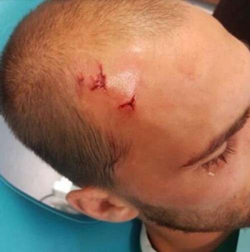 头破血流！球迷暴打球员 葡萄牙体育发声明痛斥“足球流氓”