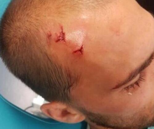 输球挨K?球迷暴打球员 