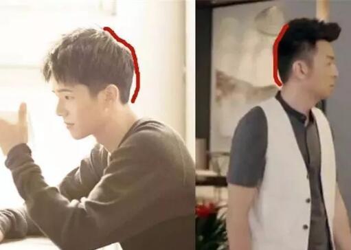 速看get!头型睡偏了还能圆回来吗?7招防止宝宝睡偏头