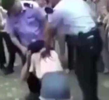 520当天，男子舌头险被女友咬断 “吻别”风险大需谨慎