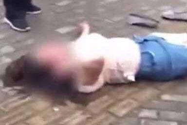 520当天，男子舌头险被女友咬断 “吻别”风险大需谨慎