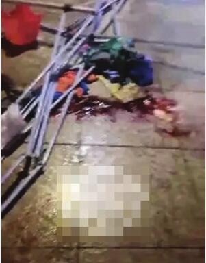 男童充气城堡身亡 77岁阿婆护住孙子自己眉骨受伤缝了7针