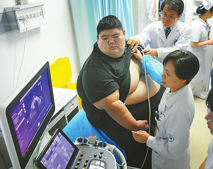 668斤!山东第一胖纪录刷新 住院准备减肥