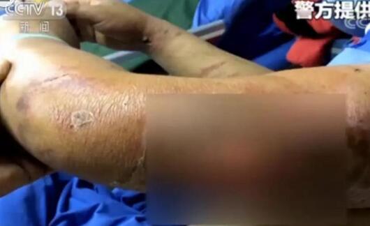 境外赌场机票住宿全免？ 唯一回路是等中国警察解救