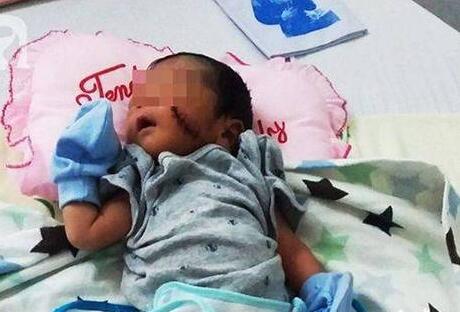 惨不忍睹!越南男婴被活埋 面色苍白脐带未剪脸上有一条4厘米长的伤口