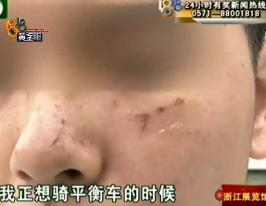 如此激烈?打篮球被抓成花脸 小伙被十几个广场舞大妈围殴