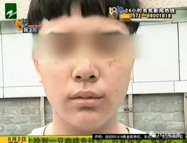 全武行!打篮球被抓成花脸 少年抓住第一个打自己的老奶奶往死里打