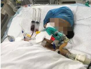 女子解除婚约被捅 90后少女被男友深夜猛刺6刀!泼汽油烧伤父亲