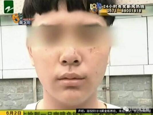 一言不合就火拼?打篮球被抓成花脸 大妈变