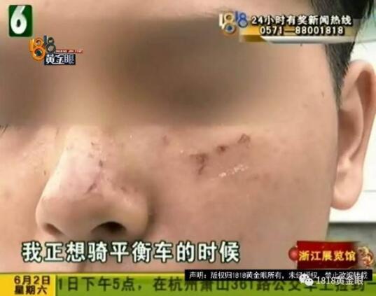 一言不合就火拼?打篮球被抓成花脸 大妈变