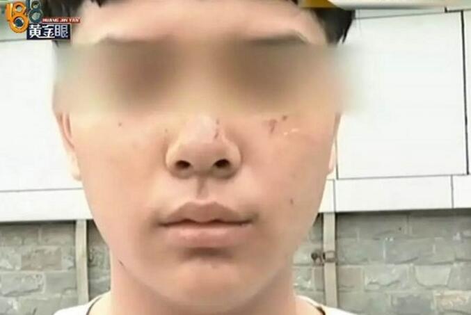 一言不合就开打?打篮球被抓成花脸 广场舞大妈惹不起