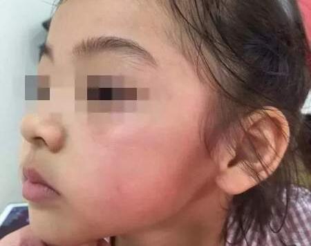 4岁女孩被掌掴 当妈的心都碎了