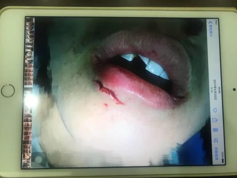 杯子把人炸晕！水杯自爆案一审 当心：宜家3块9的这款杯子仍在卖！