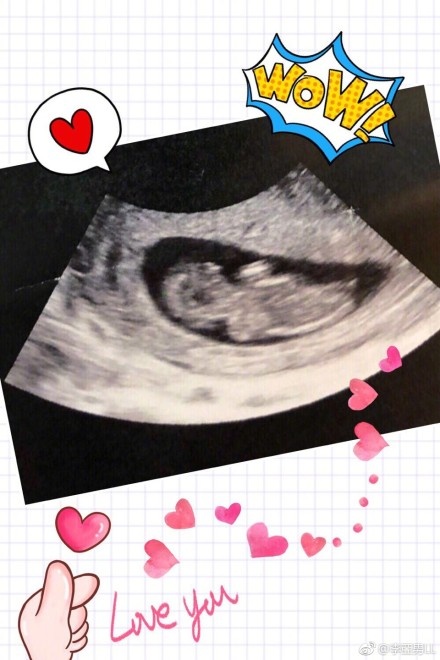 王府有喜！祖蓝升级当爸了 李亚男拍拖9周年纪念日送大礼