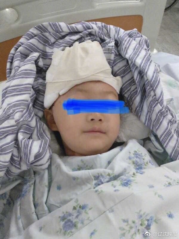 命悬一线!铅弹击中女童头部 鲜血从头部涌出流了满脸满身