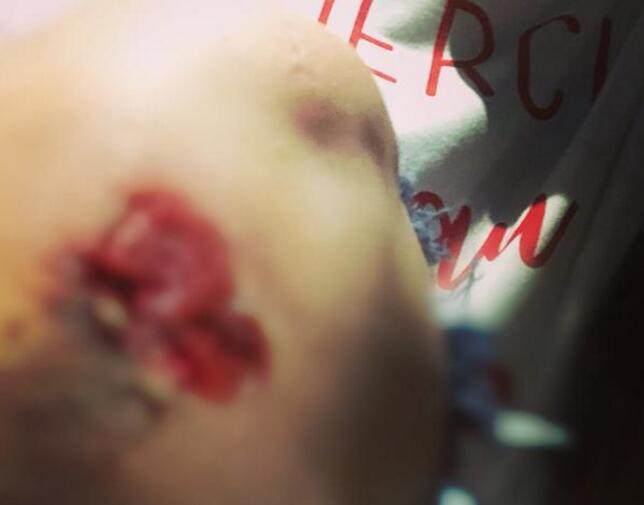 血肉模糊！阿娇为拍月食摔跤：有点吓人老公一定心疼死了