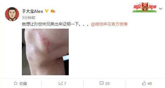 求抱抱吗?于大宝diss孙世林 国安和申花这对老冤家的针锋相对