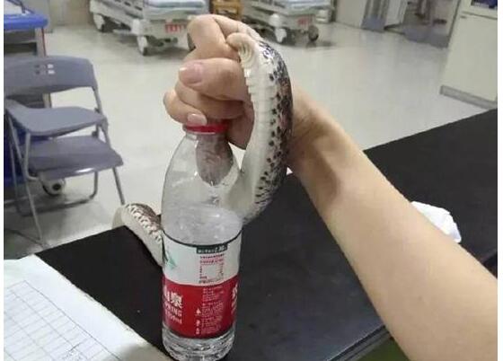 力求高度还原事情经过？抓活蛇看急诊 姑娘被蛇咬抓活蛇就医