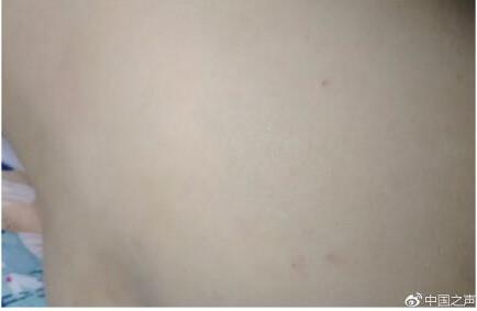 容嬷嬷出现！曝幼儿园针扎幼儿 家长反映的真相情况属实吗?