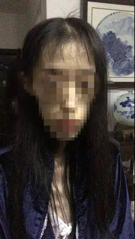 要瘦不要命?女孩减肥剩50斤 她骨瘦如柴的样子太恐怖