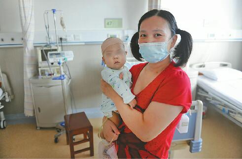 7个月大男婴患先天性胆道闭锁 42岁妈妈切肝救子
