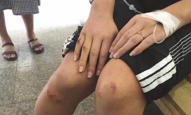 女乘客投诉深夜滴滴司机打伤乘客 客服:72小时回复