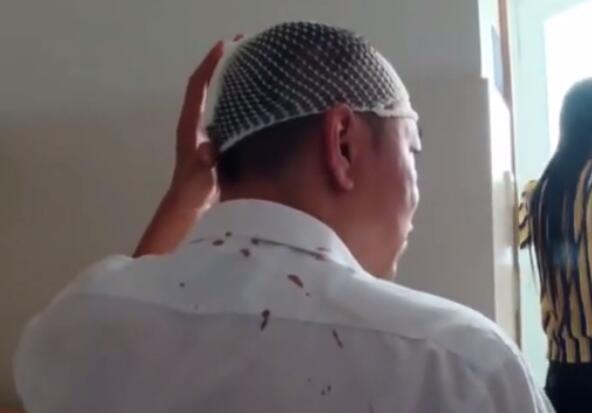 真相来了!劝阻吃面被打伤究竟怎么回事?背后原因及详情始末令人发指