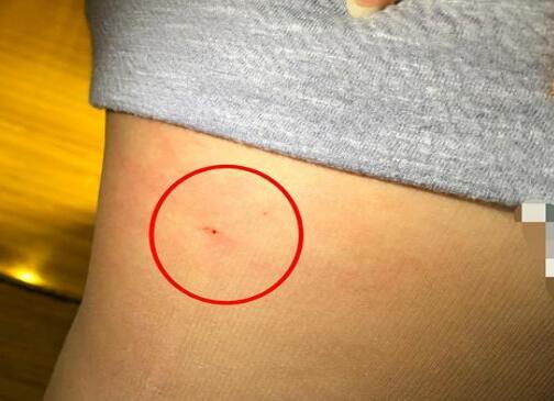 犯案动机是何?草莓藏针事件 藏针者是一名50岁女子可被判10年监禁