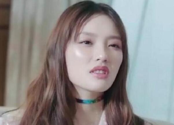 终于真相了?林允回应脸型变化晒照回击 整牙如整容依旧好看又完美