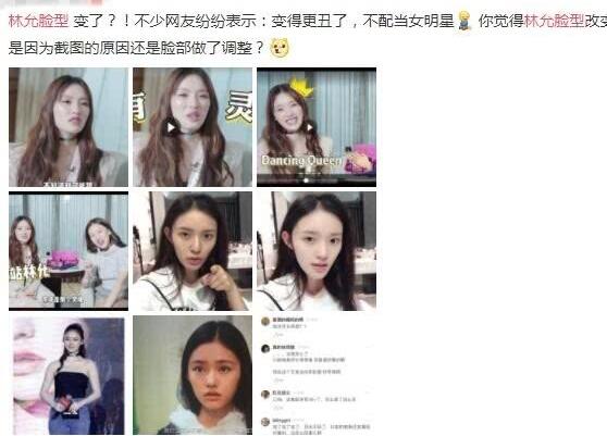 终于真相了?林允回应脸型变化晒照回击 整牙如整容依旧好看又完美