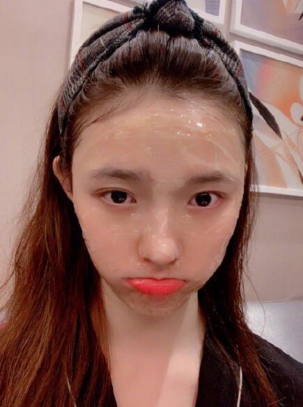 终于真相了?林允回应脸型变化晒照回击 整牙如整容依旧好看又完美