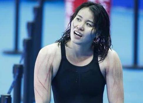 实至名归!傅园慧混合泳银牌 傅园慧自虐满臂抓痕