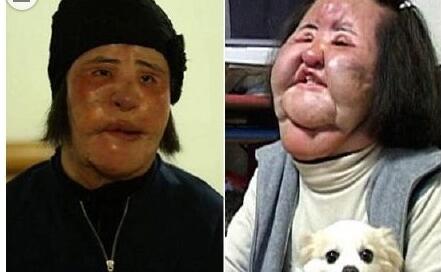 悲剧!电风扇阿姨去世她是谁?昔日美艳模特恋上整容最后变