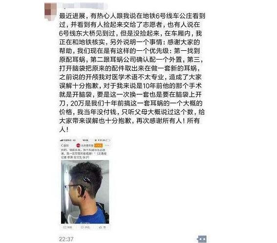 是道德绑架吗?丢失人造耳蜗进展最新消息:当事人的姐姐谢绝一切捐款