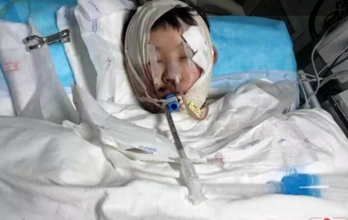 心碎了!扶老人被撞成重伤是怎么回事?详情始末曝光令网友震怒不已