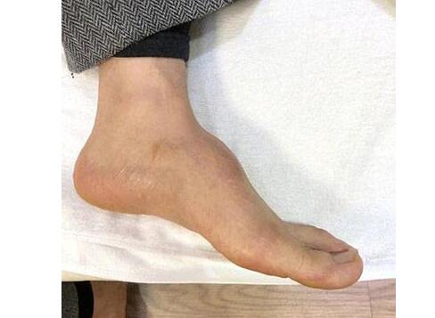 终于真相了!黄晓明增高鞋垫是怎么回事?