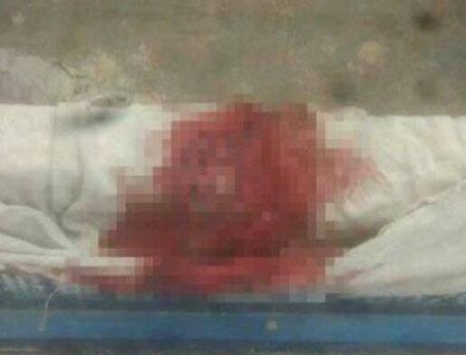 真相细思极恐!女生被打下体出血是怎么回事?背后原因详情震惊网友