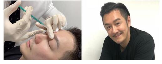 惊呆了!陈浩民承认整容具体什么情况?详情始末曝光终于真相了