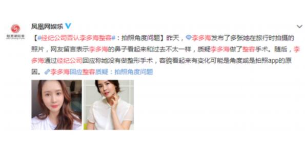 整容传闻？李多海被质疑整容 回应：拍照软件让她看起来这样